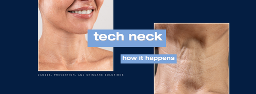 Tech Neck Explained: Causes, Prevention, and Skincare Solutions