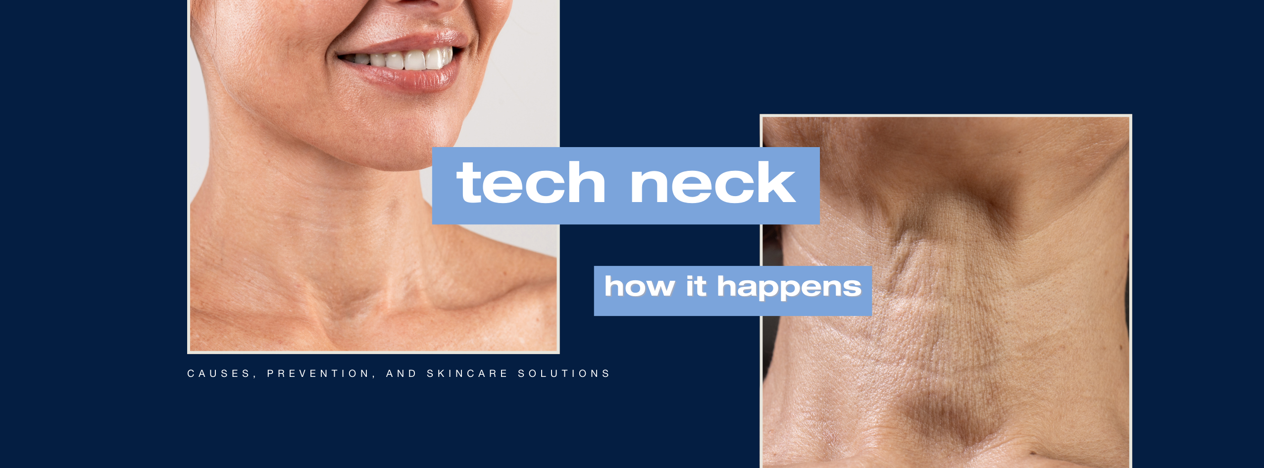 Tech Neck Explained: Causes, Prevention, and Skincare Solutions